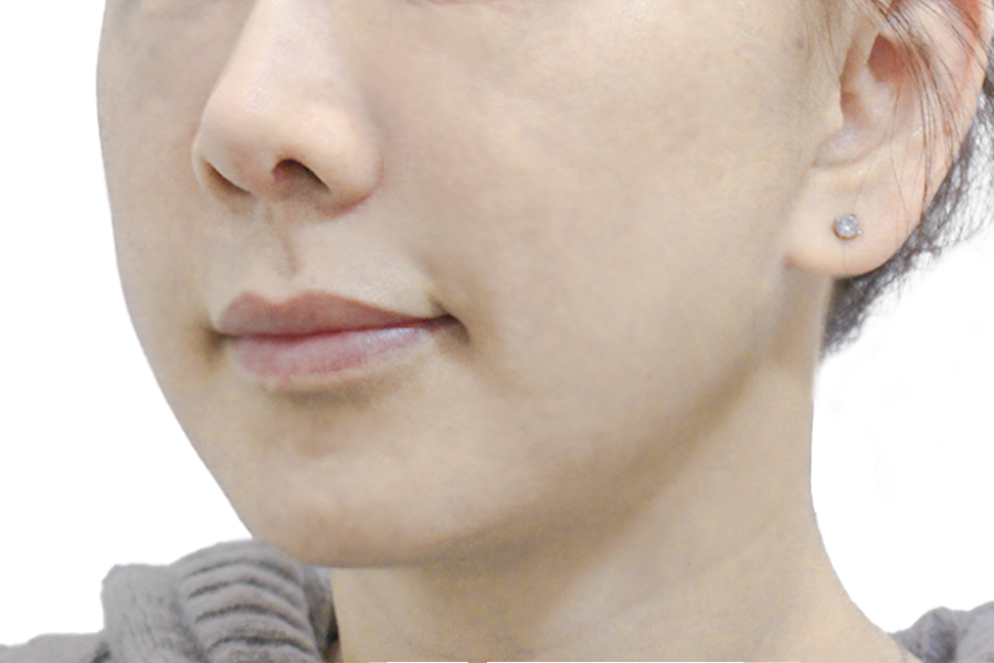 After