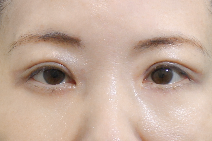 After