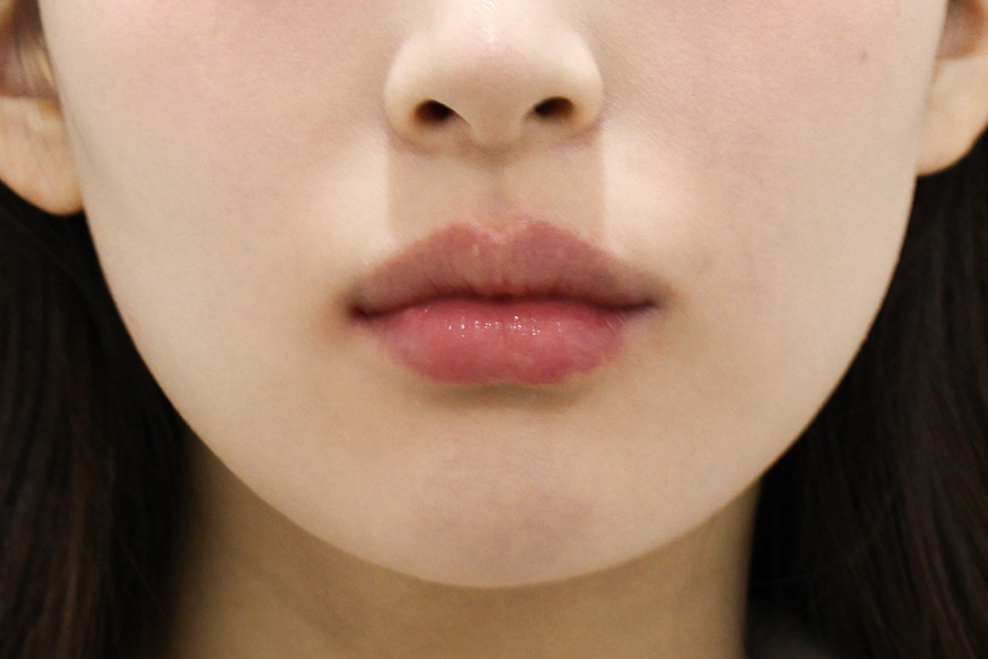 After