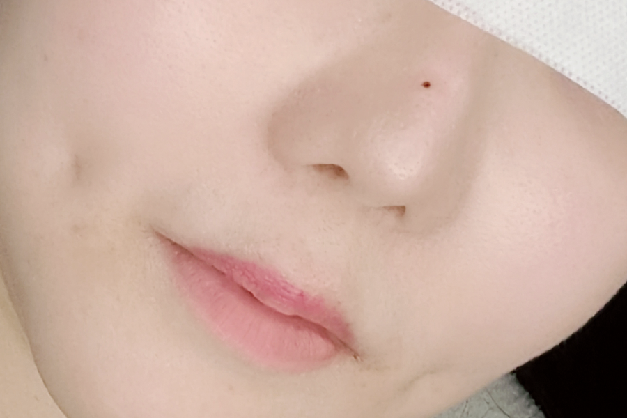 After