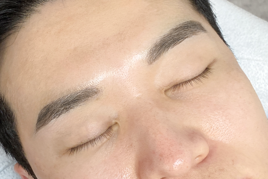 After