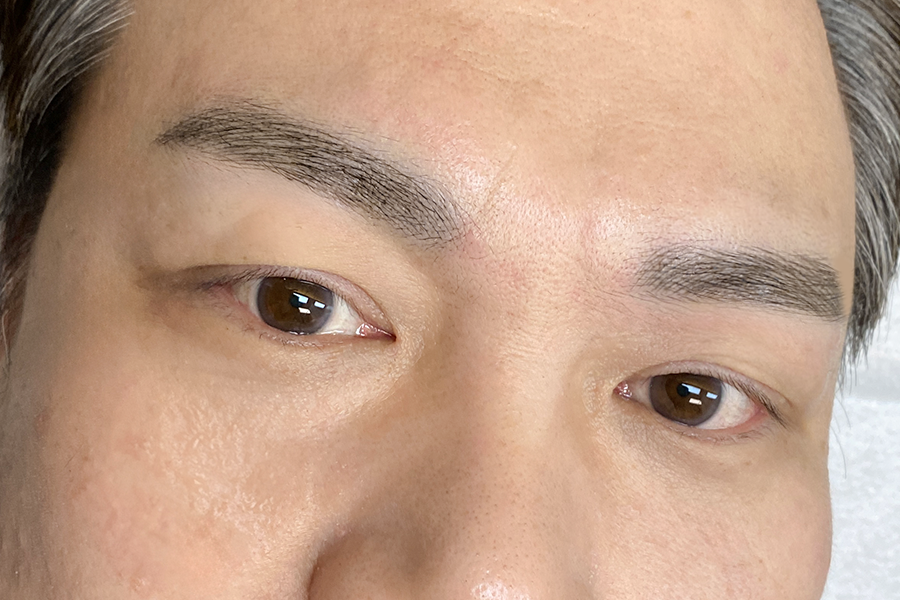After