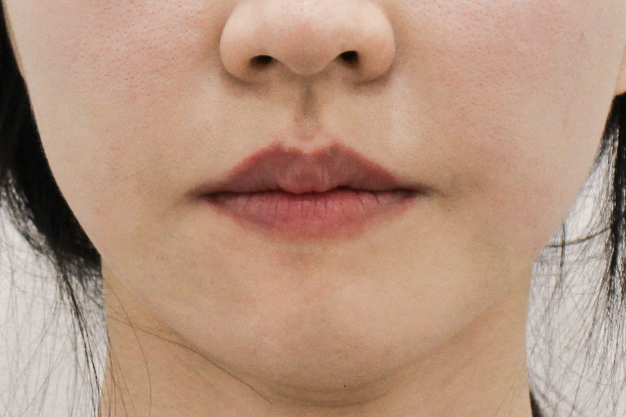 After
