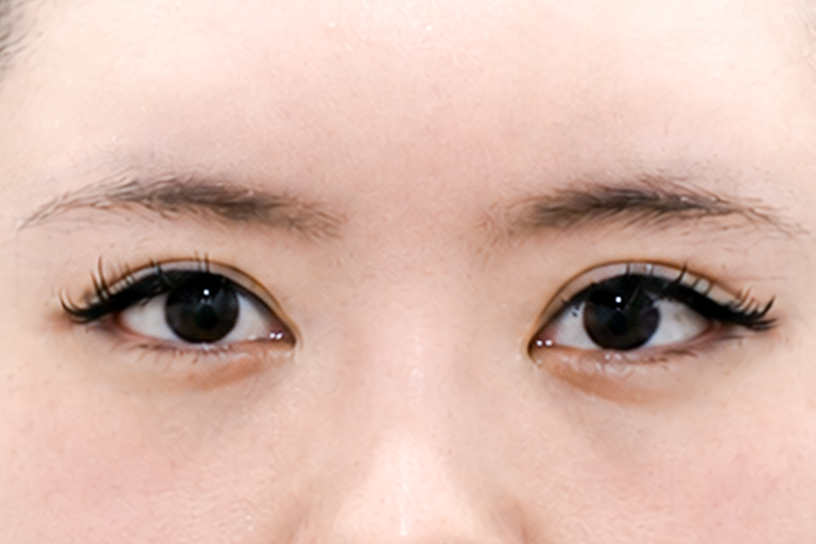 After
