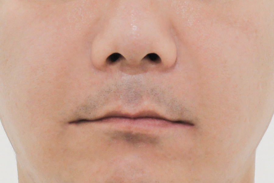 After