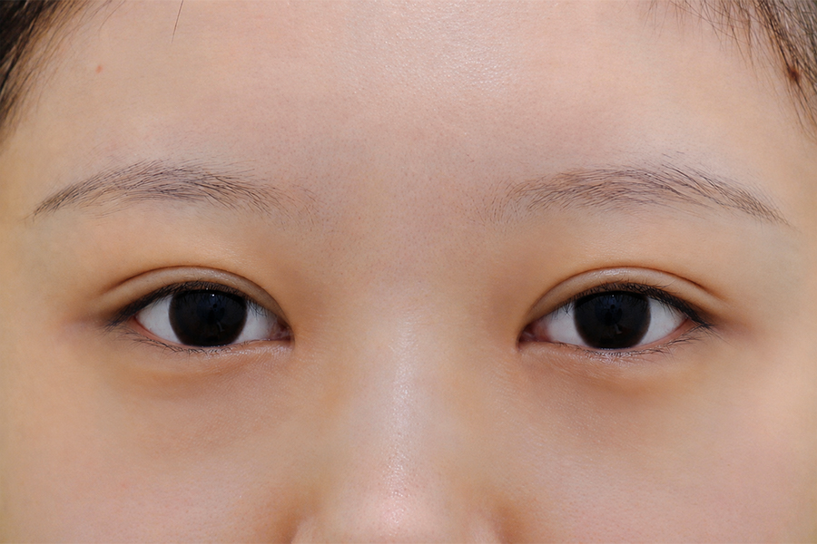 After