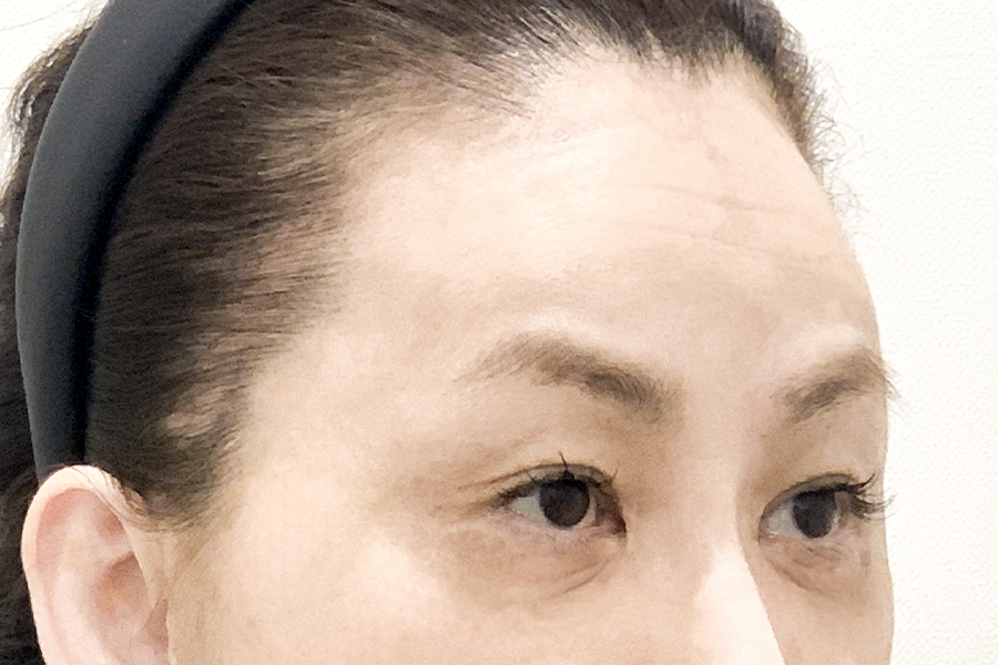 Before