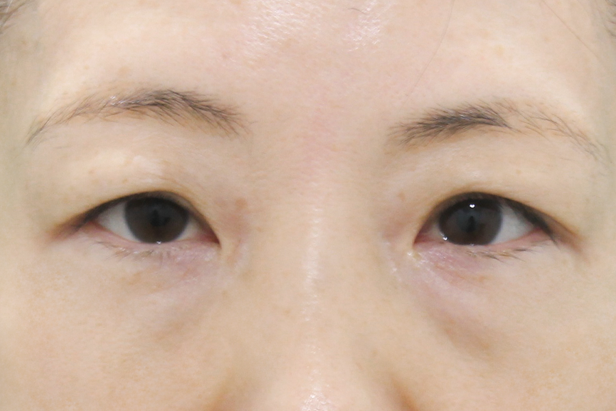 Before