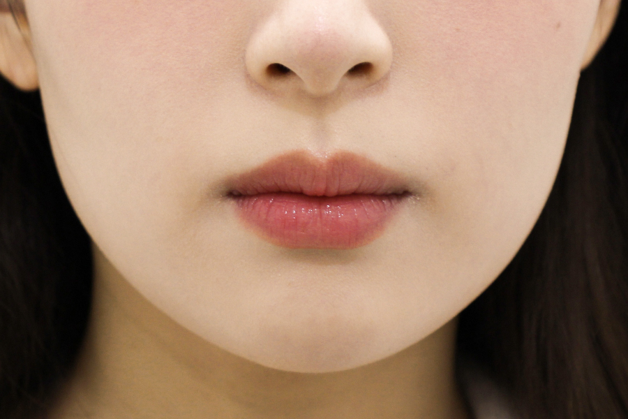 Before