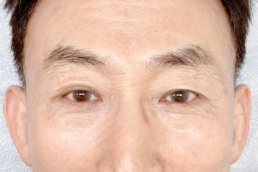 Before