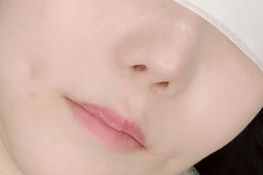 Before