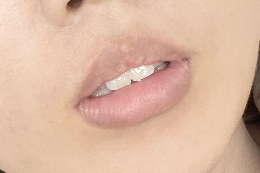 Before