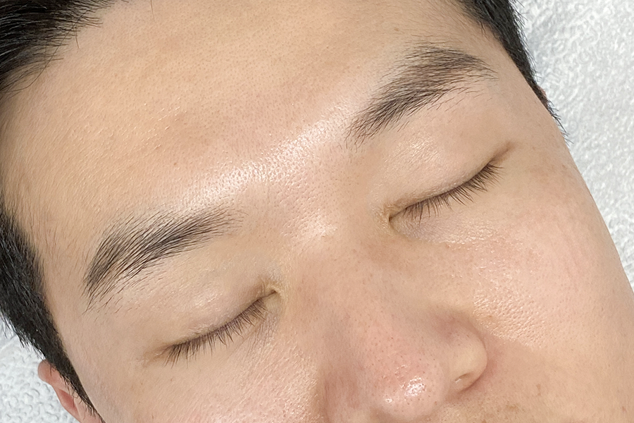 Before