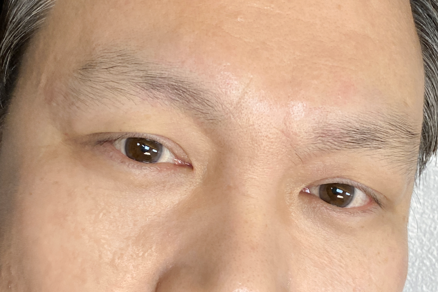 Before