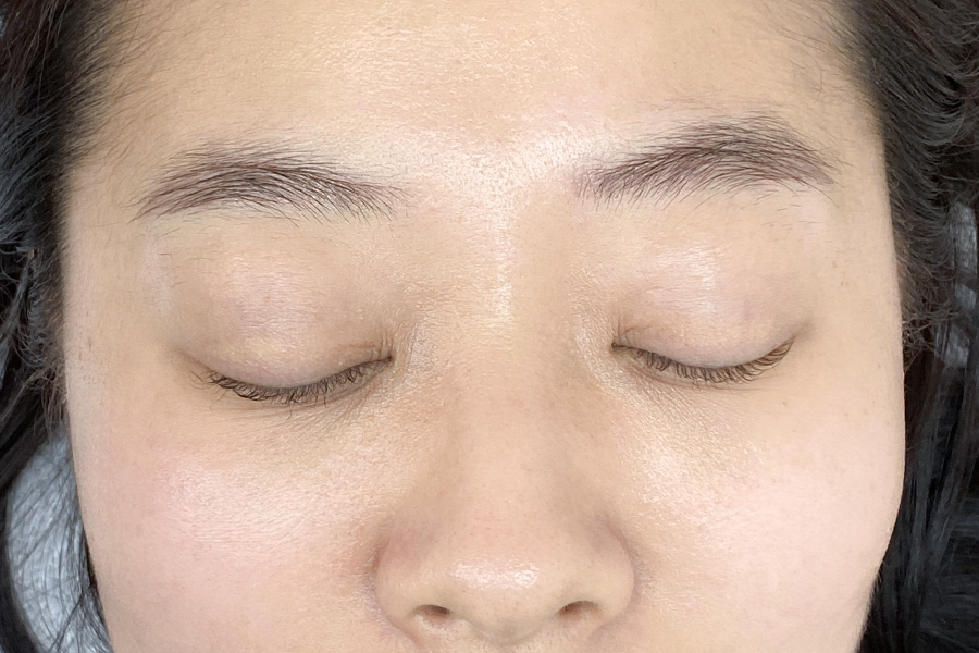 Before