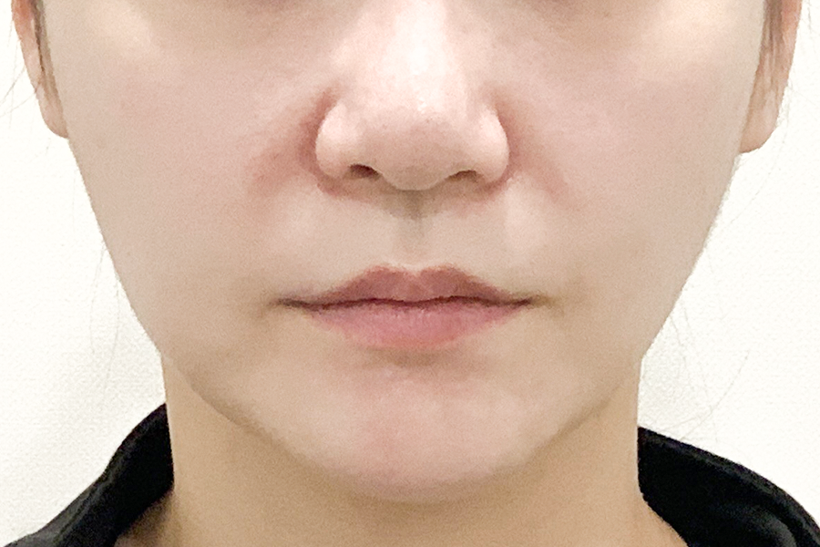 Before
