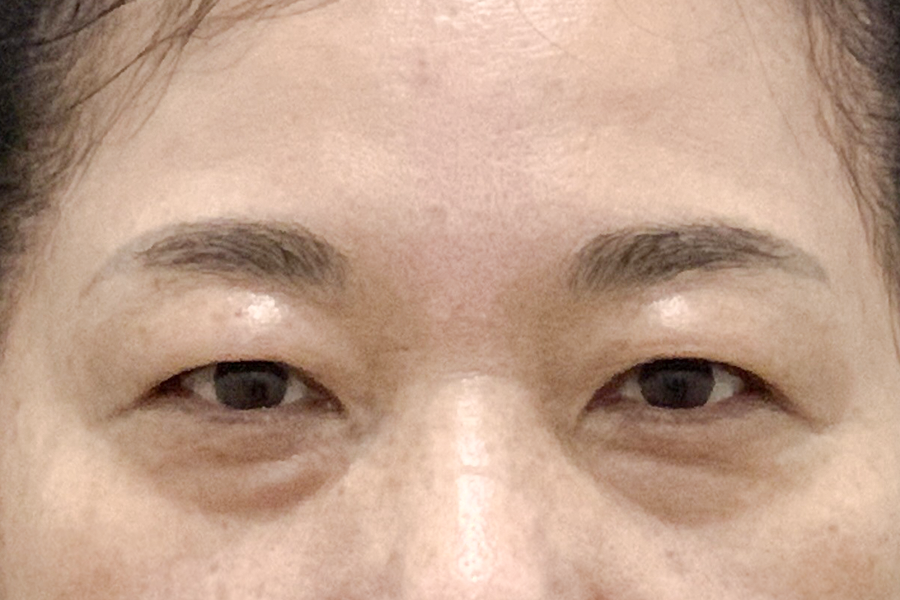 Before