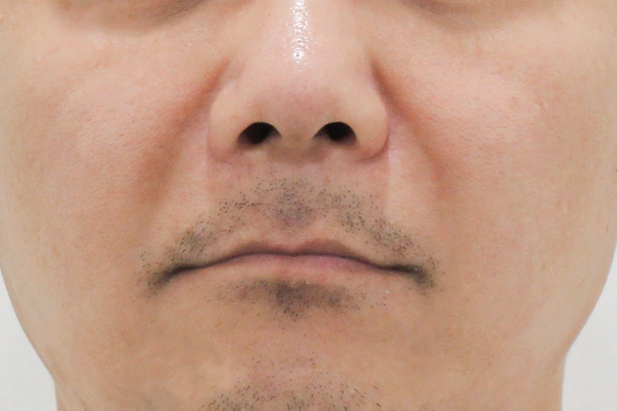 Before