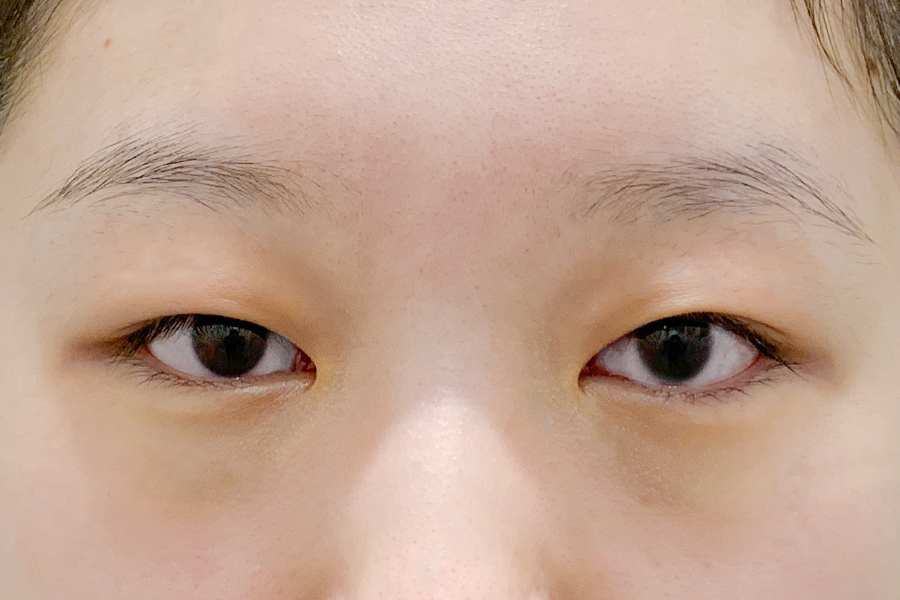 Before